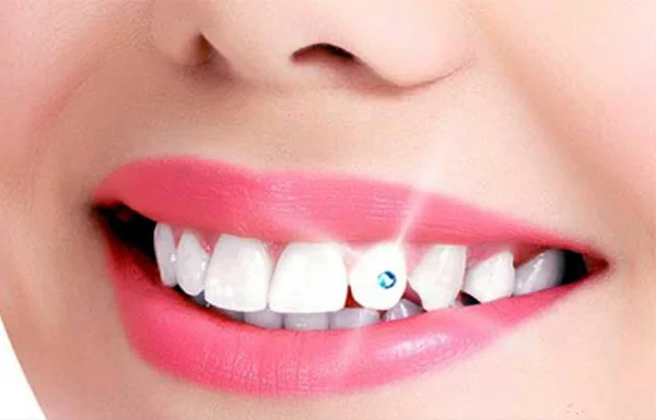 Tooth Jewellery