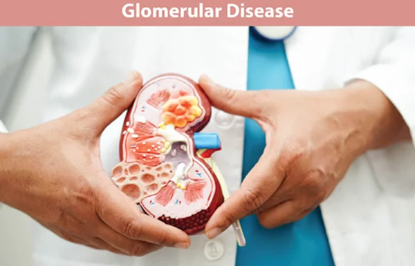 Glomerular Diseases and Rare Kidney Conditions