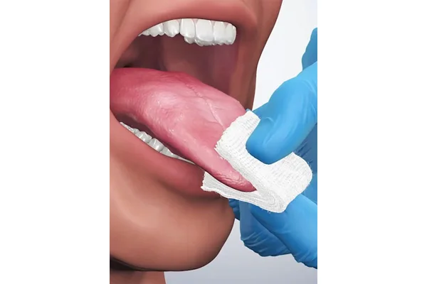 Oral Cancer Screening