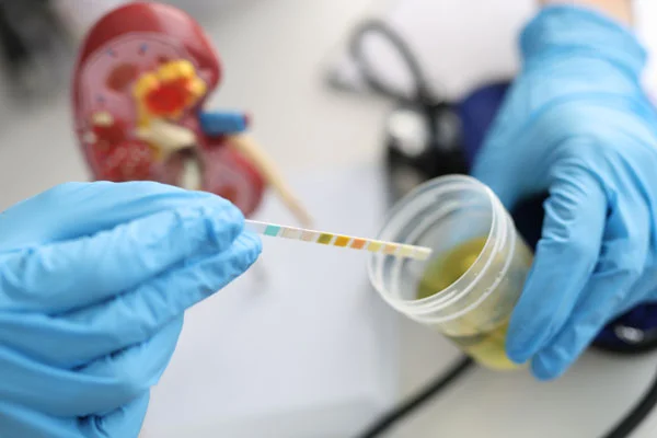 Proteinuria  Protein in Urine
