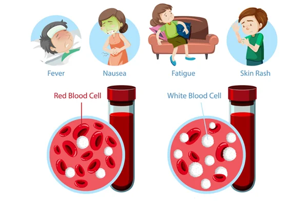 Hemolytic Uremic Syndrome