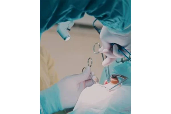 Oral Cancer Surgery